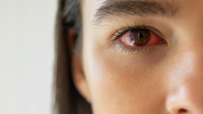 1762148268373-mata-merah_169