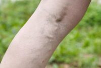 1763528757907-57d49e45-7efa-46e7-80be-7c94ec0f9dc9_169